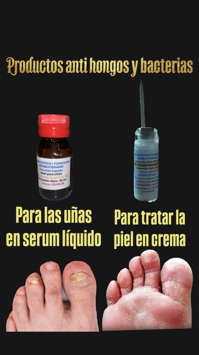 CREMA ANTI HONGOS